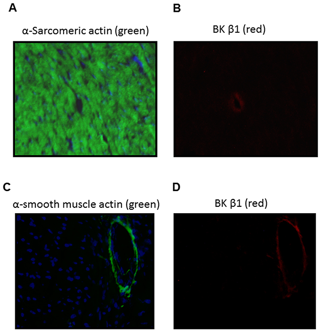 Localization of BKca channel &#x03B2;1 subunit in the LV tissues of male offspring.
