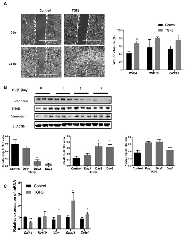 TGF&#x03B2; induces EMT in oviductal epithelial cells.