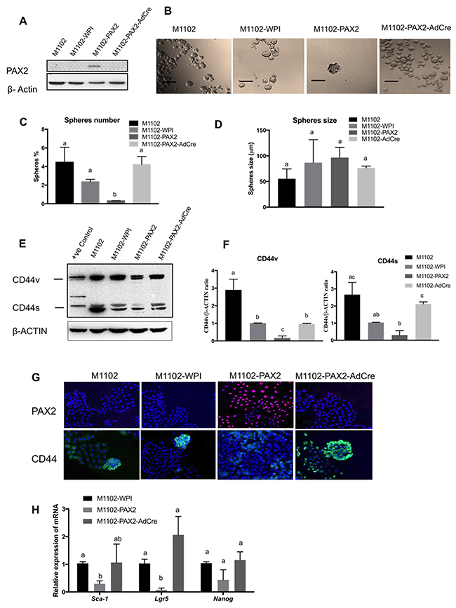 PAX2 decreases stem cell characteristics in mouse OSE cells (M1102).
