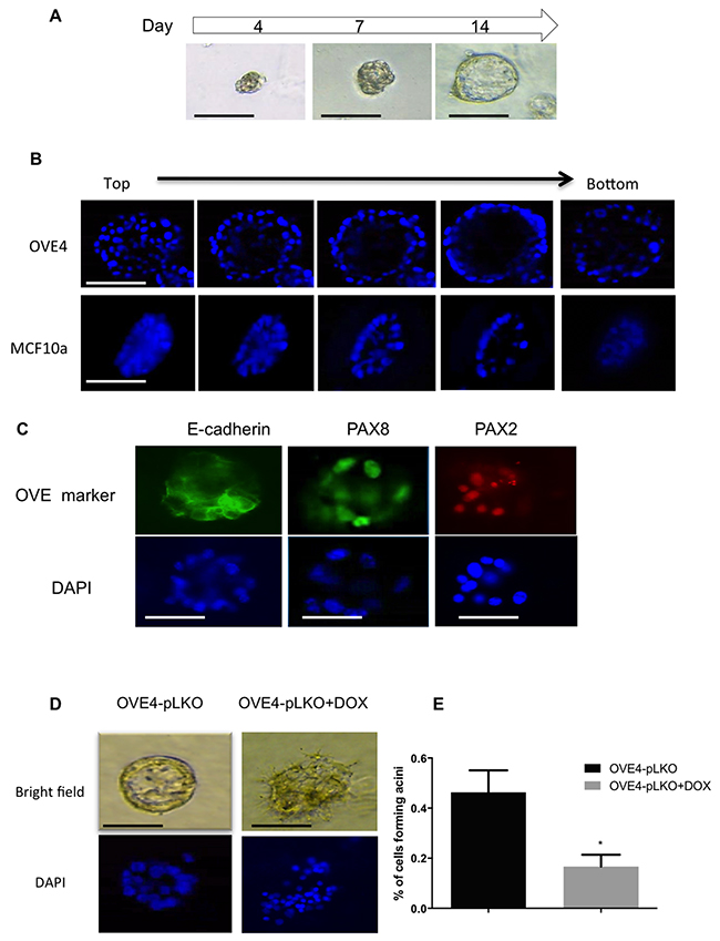 PAX2 is required for epithelial differentiation of OVE cells.
