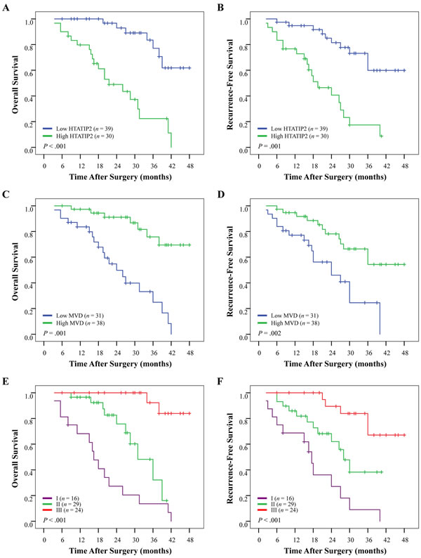 Cumulative overall survival (OS) and recurrence-free survival (RFS) curves of 69 sorafenib-administered patients with high or low HTATIP2 density and microvessel density (MVD) as well as their combination in cohort 2.