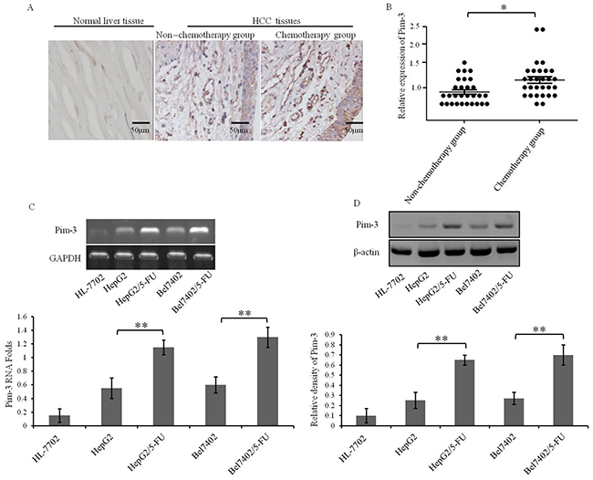 Pim-3 expression is elevated in HCC tumors from patients who underwent chemotherapy and in MDR HCC cell lines.