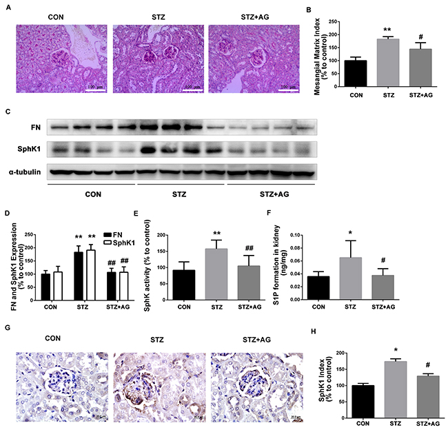 Effects of AG on FN and SphK-S1P signaling pathway in STZ-induced diabetic mice kidney.