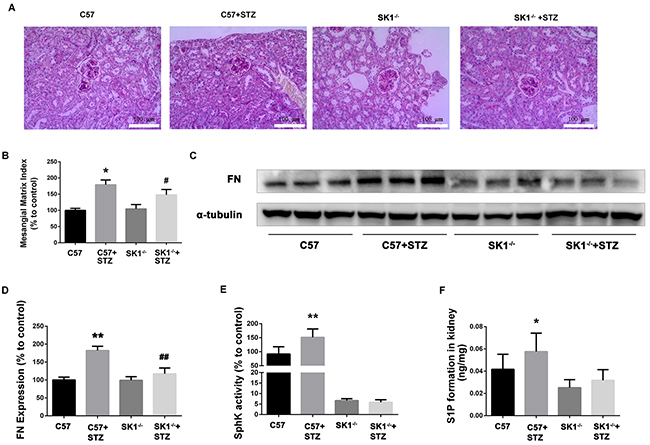 Effects of knock out SphK1 on FN and SphK-S1P signaling pathway in STZ-induced diabetic mice kidney.