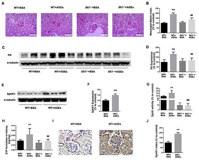 Effects of knock out SphK1 on FN and SphK-S1P signaling pathway in AGEs-induced mice kidney.