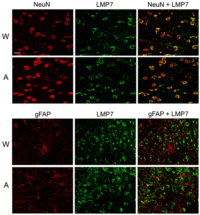 Distribution of proteasomes containing LMP7 subunit in brain cortex cells of Wistar and August rats.