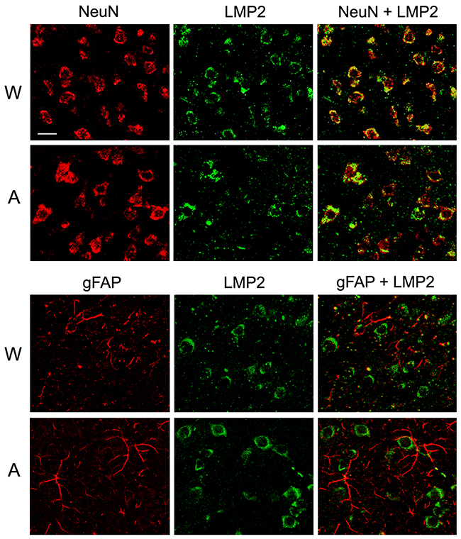 Distribution of proteasomes containing LMP2 subunit in brain cortex cells of Wistar and August rats.