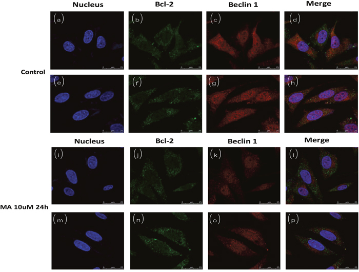 Cofocal imaging for autophagosome (subcellular localization of Beclin1 and Bcl2) in the absence or presence of MA.