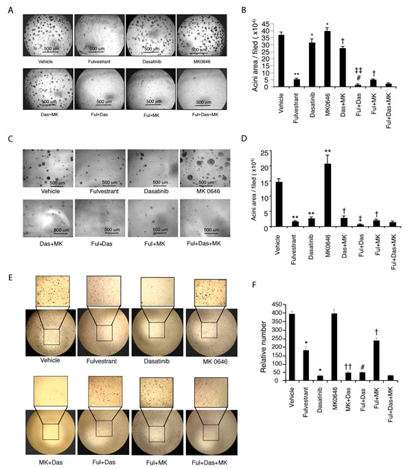 Effect of fulvestrant, dasatinib and/or MK0646 on mammary acinar morphogenesis and cell migration.
