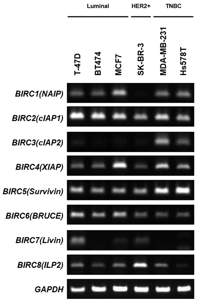 Analysis of IAP expression in breast cancer cells.