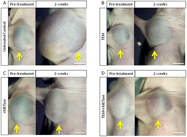 Macroscopic evaluation of therapeutic efficacy of TEM, rMETase and their combination on a BRAF V600E mutant melanoma.