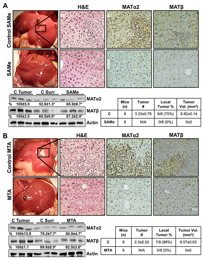 SAMe and MTA inhibit metastatic colon cancer growth in mice.