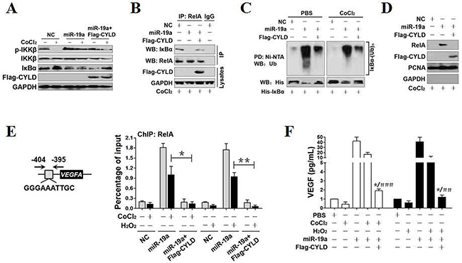 CYLD repression contributes to NF-&#x03BA;B transactivation during OS in a miR-19a-dependent manner.