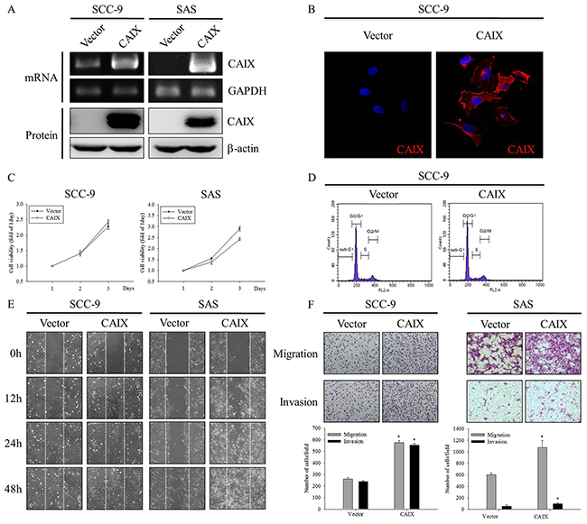 CAIX overexpression induces oral cancer cell motility.