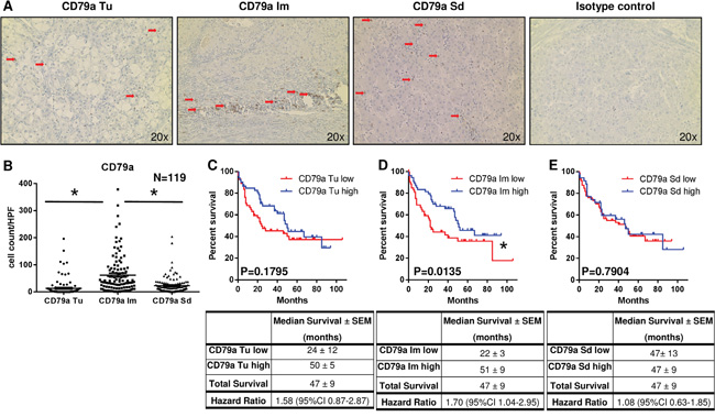 Localized infiltration of CD79a+ cells within the infiltrative margin is associated with increased patient survival.