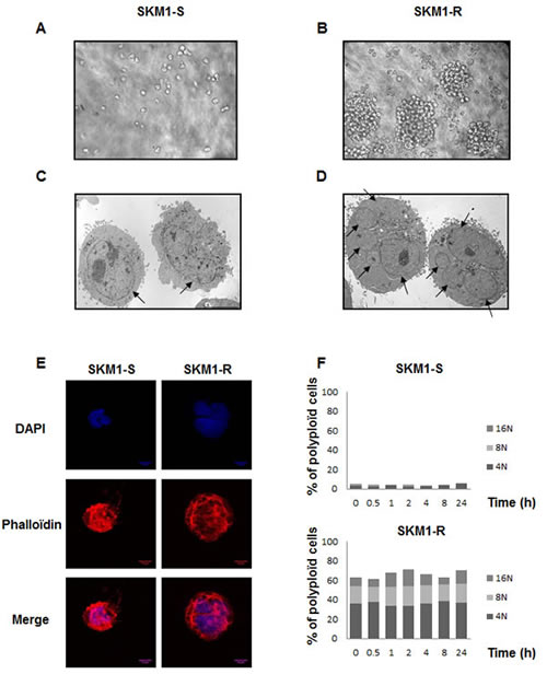 Morphologic features of SKM1-S and SKM1-R cells: Panels A and B: Phase contrast analysis of SKM1-S and SKM1-R cells (X100).