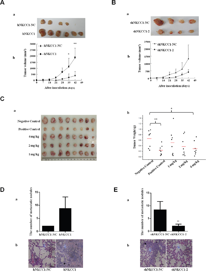 Effects of NKCC1 overexpression/knockdown and inhibitor treatment on the growth and extrahepatic metastasis of HCC cells in vivo.