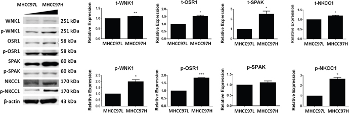 Expression levels of WNK1, OSR1, SPAK and NKCC1 in MHCC97L and MHCC97H cells.