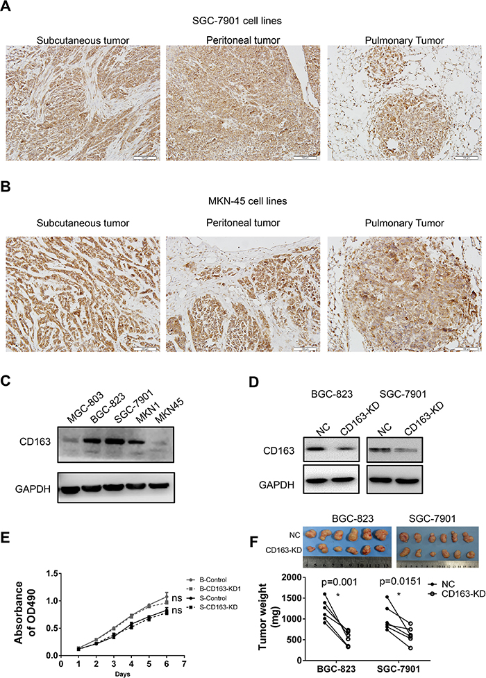 The expression and function of CD163 in gastric cancer cells.
