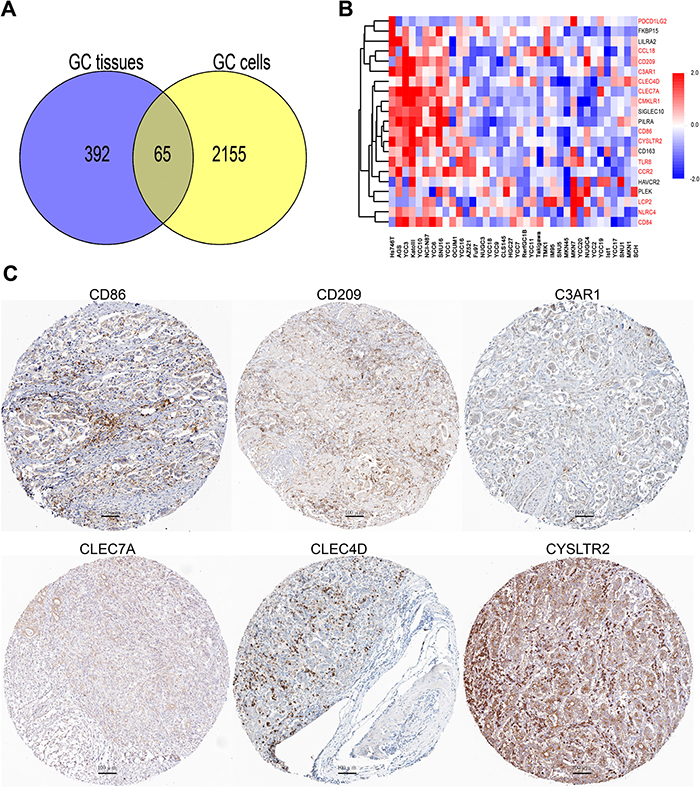 CD163 is co-expressing with various immune related genes in cancer cells.