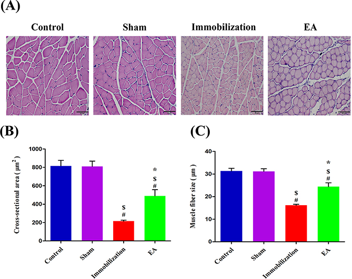 EA prevents immobilization-induced muscle fiber cross-sectional area and muscle fiber size decrease.