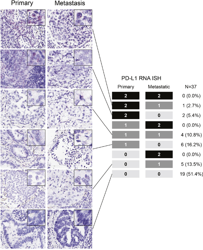 PD-L1 mRNA levels in paired surgically resected primary and metastatic tissues with representative PD-L1 RNA in situ hybridization (RISH) images.
