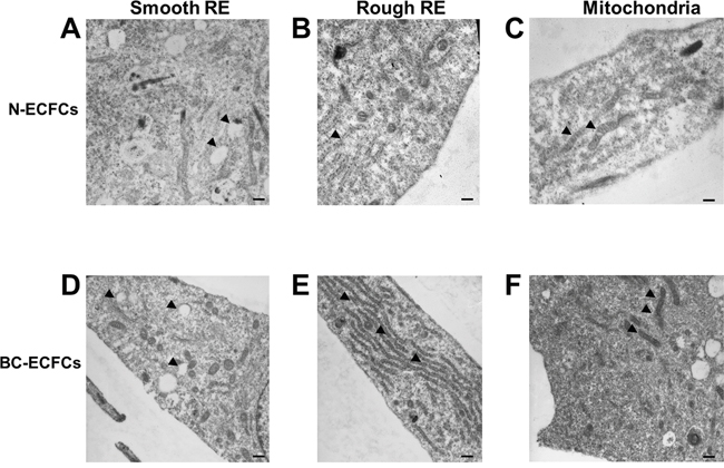 Ultrastructural remodelling in breast cancer-derived endothelial colony forming cells.