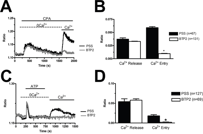 BTP2 inhibits store-dependent Ca2+ entry in breast cancer-derived endothelial colony forming cells.