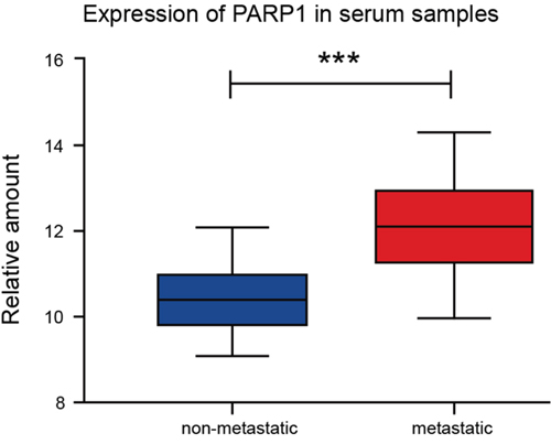 Higher expression of PARP1 in the serum samples ofmetastatic-NSCLC patients.
