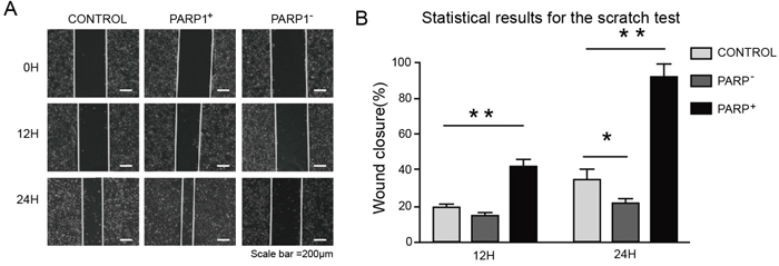 Promoting effect of PARP1 on migration of NSCLC cell.