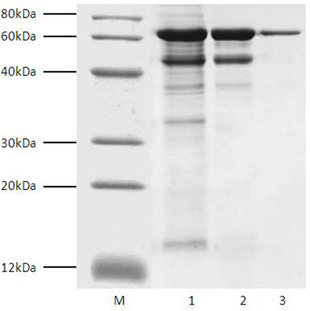 SDS-PAGE analysis of fractions during T&#x03B1;1-HSA purification. Lane M, marker; Lane