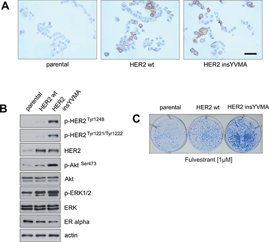 Establishment of fulvestrant-resistant ER&#x03B1;-positive breast cancer cells that express a constitutively active HER2 mutant that is resistant to inhibition by trastuzumab and lapatinib.