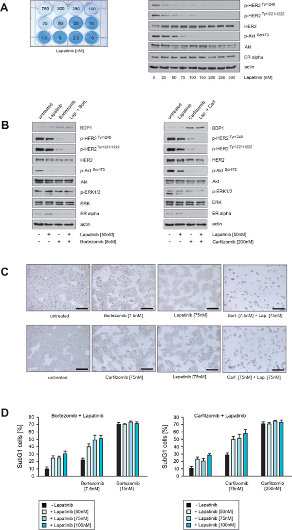 Carfilzomib and bortezomib act in concert with lapatinib to inhibit HER2 activity and to induce cell death in ER+/HER2+ breast cancer cells.