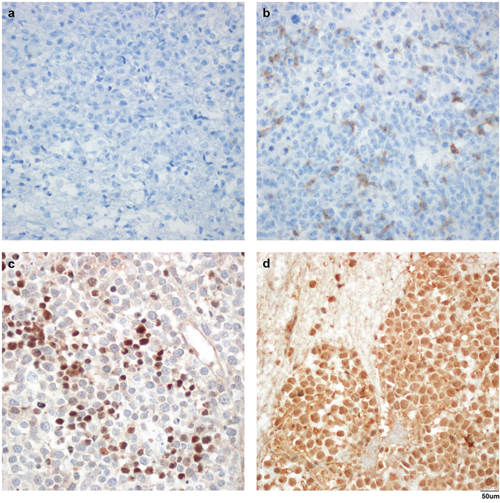 Representative immunohistochemical stains in formalin-fixed and paraffin-embedded samples.