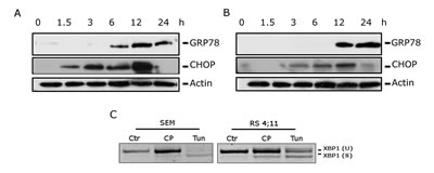 FIGURE 4: CP induces ER stress.