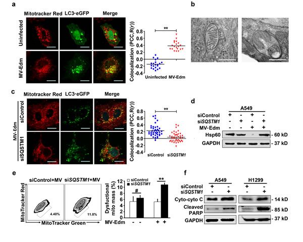 MV-Edm induces mitophagy to control cytochrome C release in NSCLCs.