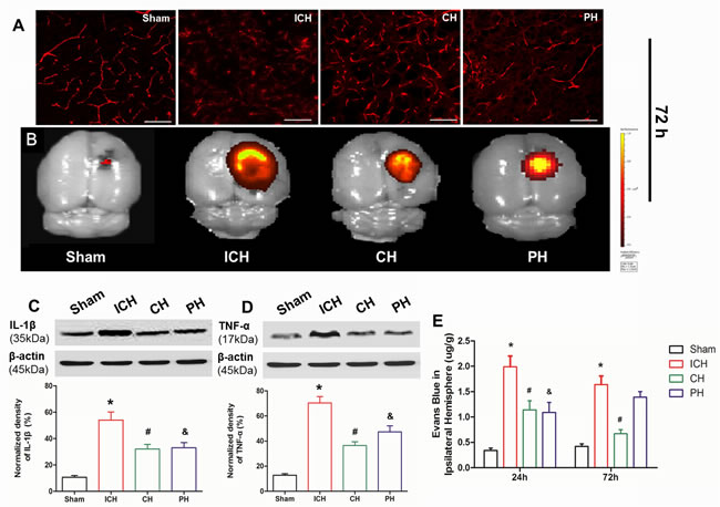 Effects of hypothermia on early blood-brain barrier damage following intracerebral hemorrhage (ICH).