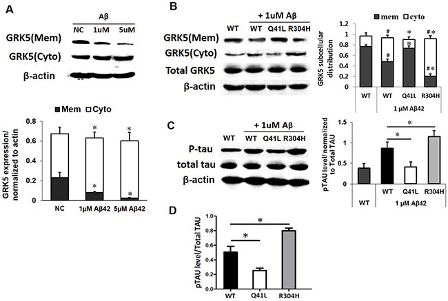 GRK5-Gln41Leu variant protects against low threshold A&beta;42 stimulation.