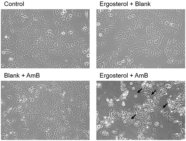 Ergosterol followed by AmB treatment induced cell rounding and debris accumulation in HepJ5 cells.