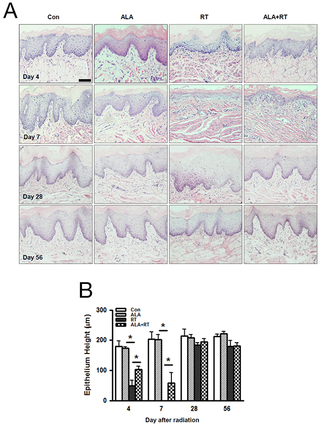 Histopathological changes in the oral mucosa 4, 7, 28, and 56 days after irradiation.