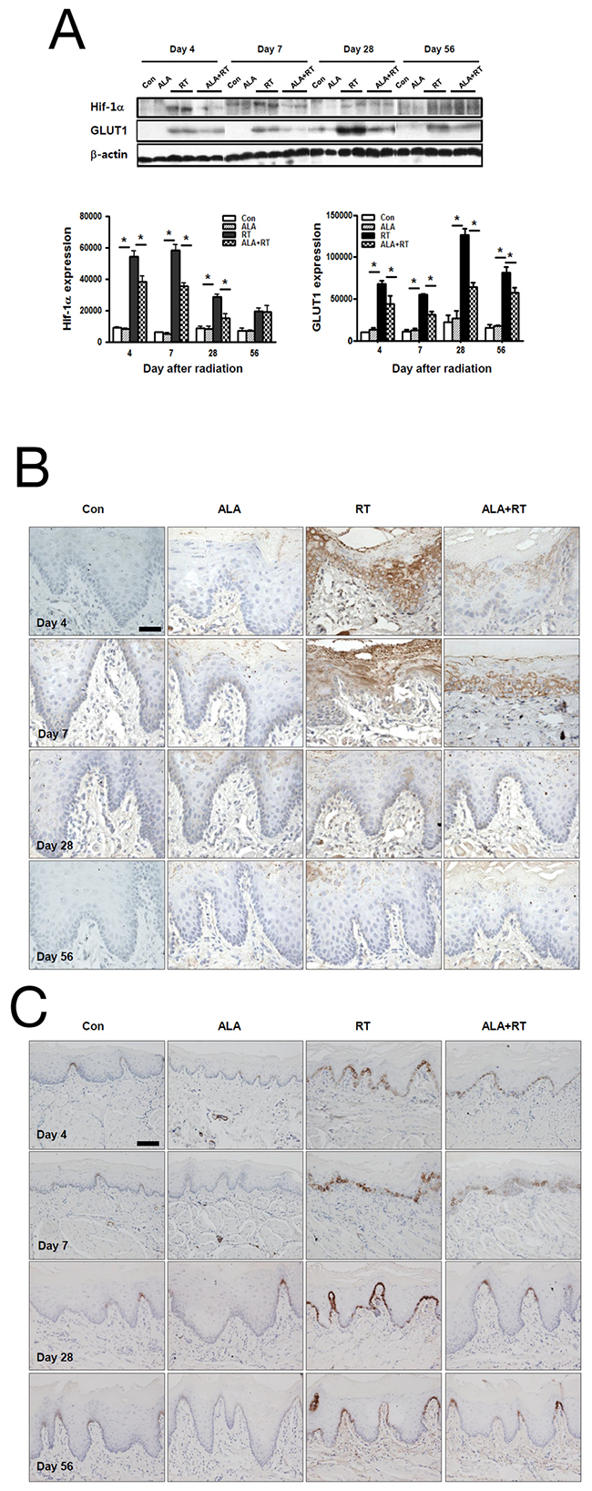 ALA decreases Hif-1a and GLUT1 expression in the oral mucosa.
