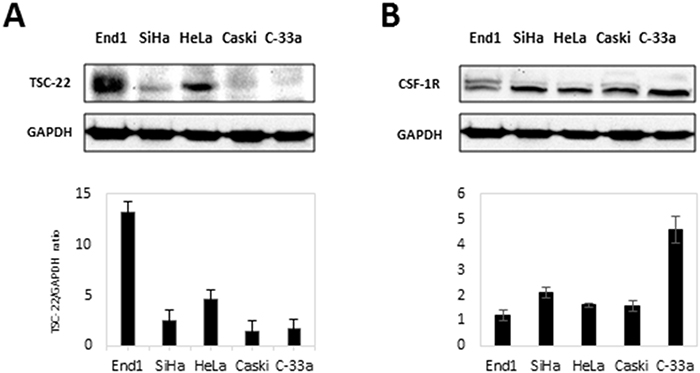 Protein levels of CSF-1R and TSC-22 in cervical cancer cells.