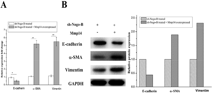 The EMT of the A549 cells with down-regulated Nogo-B were recovered by the up-regulated Mmp14.