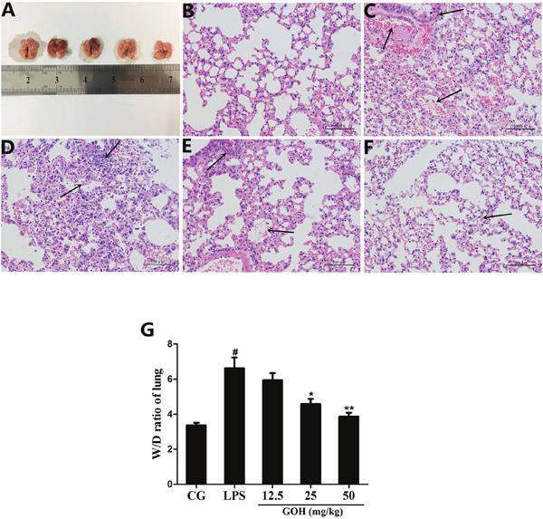 Effects of GOH on LPS-induced lung injury.