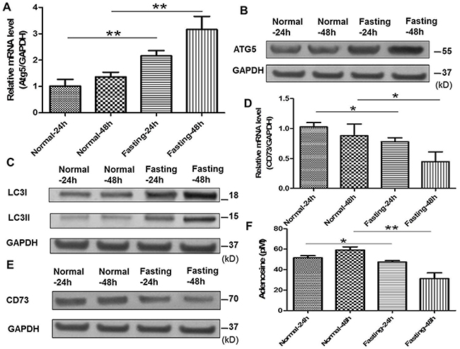 Fasting induces cancer cell autophagy, downregulates CD73 expression of cancer cells and suppresses adenosine generation in vitro.