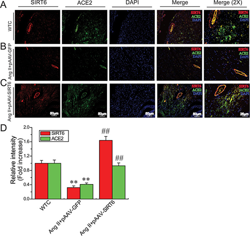 Myocardial SIRT6 and ACE2 levels in rat hearts.