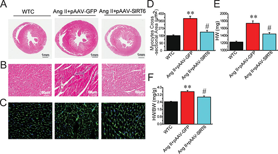 Effects of pAAV-SIRT6 treatment on myocardial hypertrophy in response to Ang II.