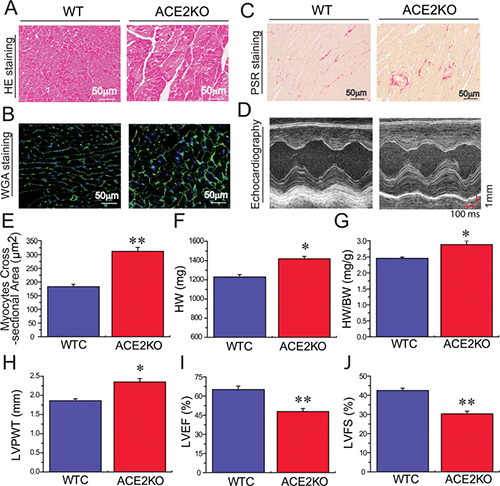 ACE2 deficiency results in increased cardiac hypertrophy, fibrosis and impaired heart function.