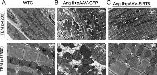 Effects of pAAV-SIRT6 treatment on myocardial ultrastructure injury mediated by Ang II.