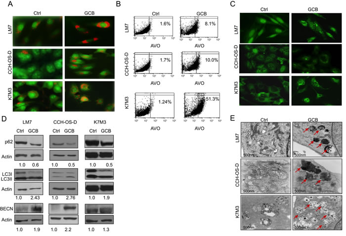 Treatment with gemcitabine (GCB) induces autophagy in osteosarcoma cells.